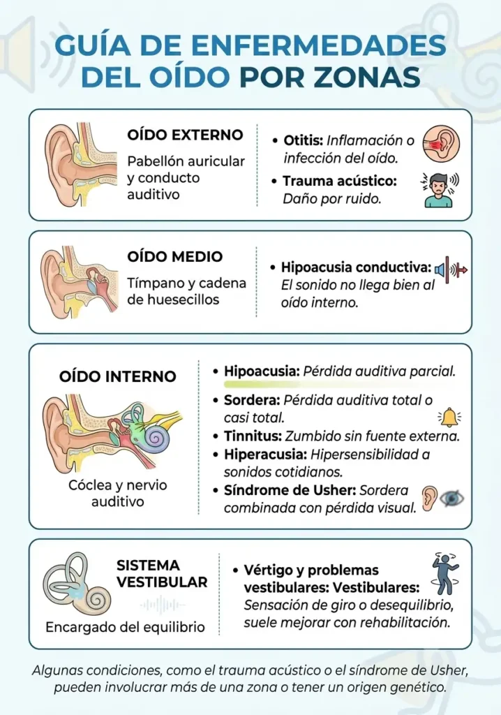 Enfermedades del oído por zonas, guia gráfica